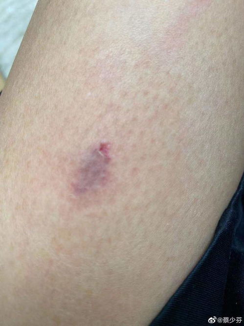 孕妇被狗咬 主人称狗咬的让狗道歉